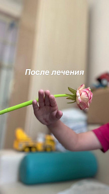 В Иванове неврологи вернули 5-летней пациентке подвижность кисти 